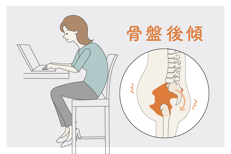 デスクワークで骨盤が後傾しお腹がぽっこり